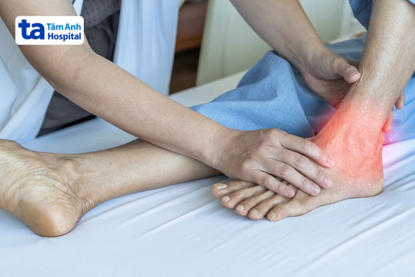 Đứt gân Achilles là một chấn thương phổ biến