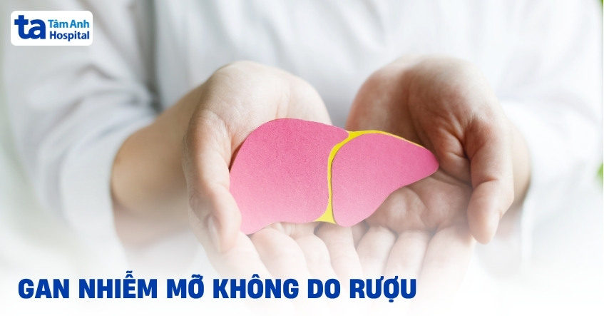 Gan nhiễm mỡ không do rượu: Nguyên nhân và cách phòng ngừa