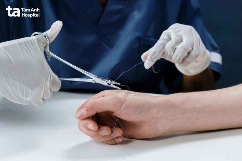 Chỉ định và chống chỉ định kỹ thuật gây tê tại chỗ