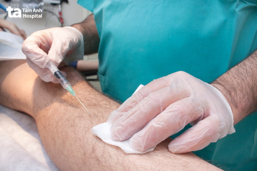 Quy trình gây tê tại chỗ an toàn