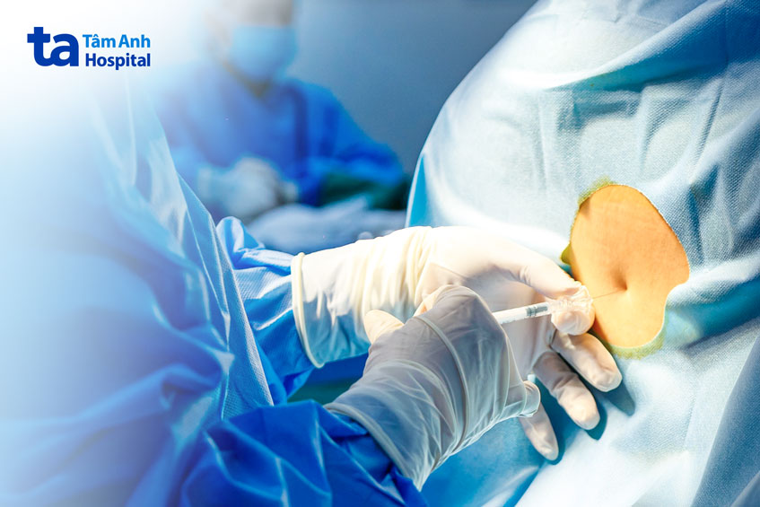 gây tê tủy sống để đảm bảo an toàn