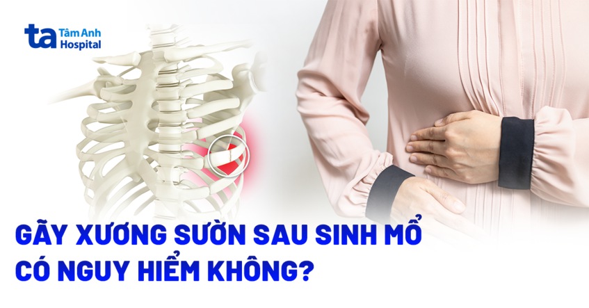 Gãy xương sườn sau sinh mổ có nguy cơ xảy ra không?