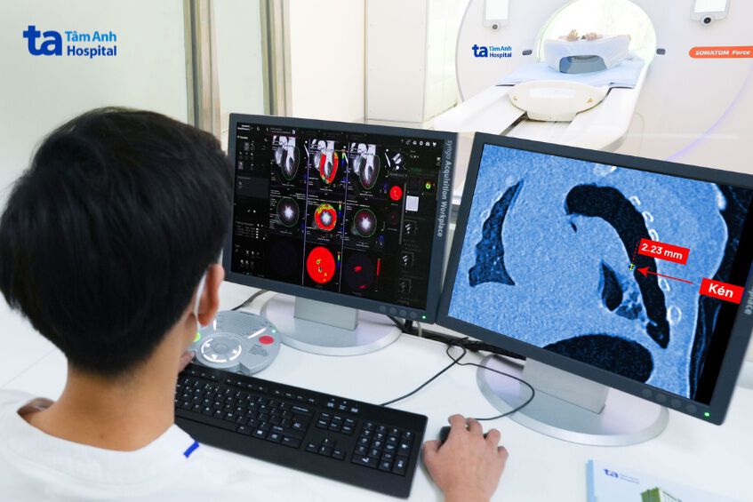 hệ thống máy chụp ct somatom vb30