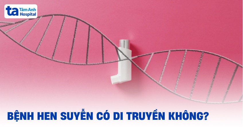Hen suyễn có di truyền không? Yếu tố nào tăng nguy cơ mắc bệnh?