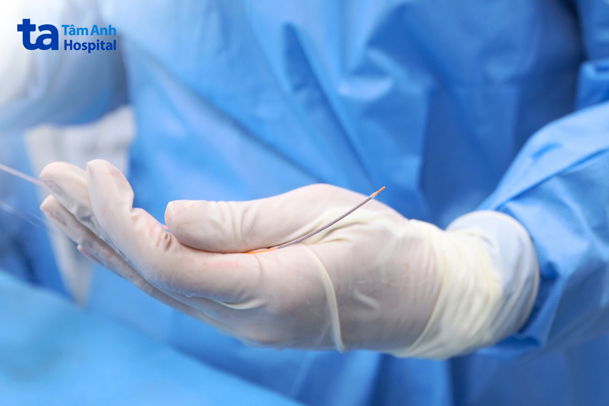 hình ảnh bác sĩ trong phòng phẫu thuật đang cầm ống stent mạch máu vô trùng