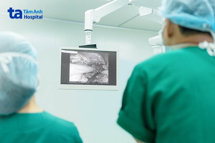 hình ảnh khối u