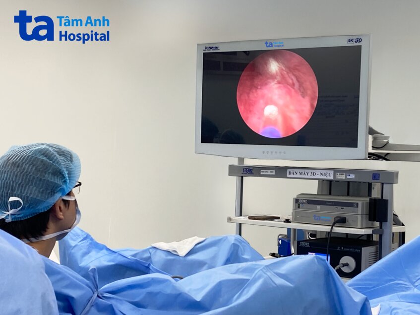 hình ảnh nội soi phẫu thuật