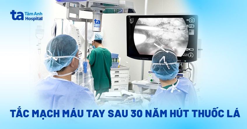 Hút thuốc lá, người đàn ông tắc mạch máu tay