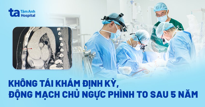 Không tái khám định kỳ, động mạch chủ ngực phình to sau 5 năm
