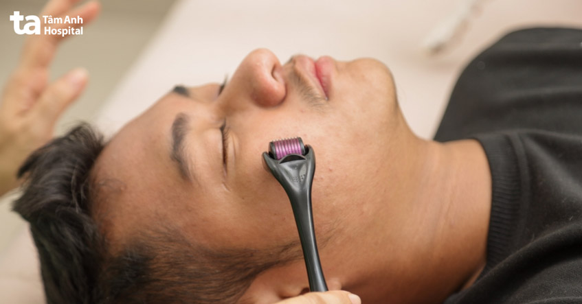 phương pháp chỉ hỗ trợ cải thiệ