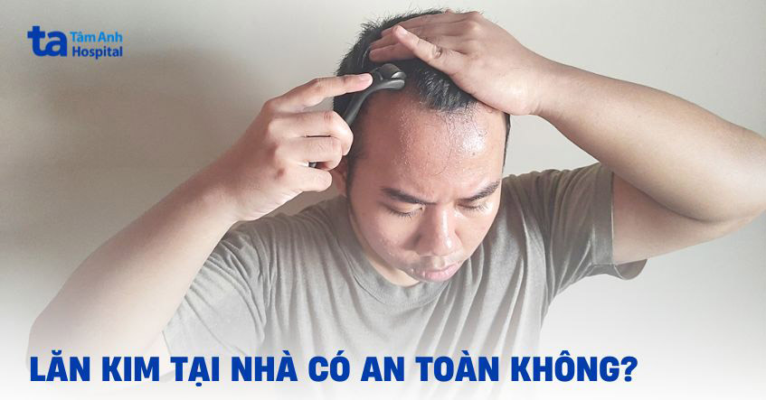 Lăn kim tại nhà có an toàn không? Tại sao không khuyến khích?