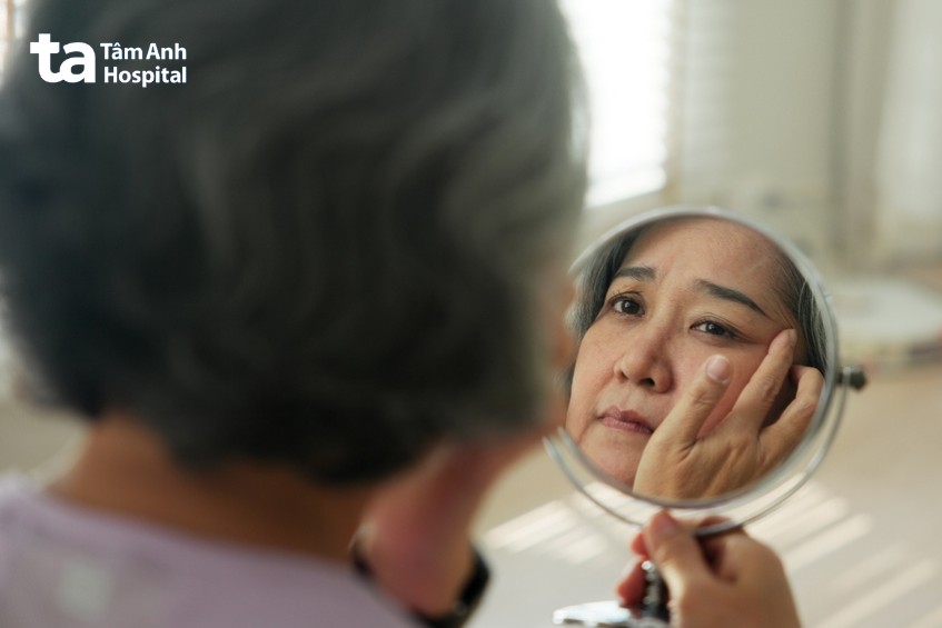 lão hóa gây chảy xệ tạo cảm giác mặt to