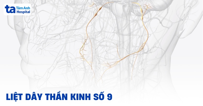 Liệt dây thần kinh số 9: Dấu hiệu, nguyên nhân, điều trị