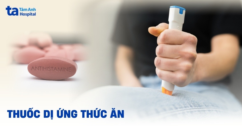4 loại thuốc dị ứng thức ăn có thể tham khảo ý kiến bác sĩ khi dùng