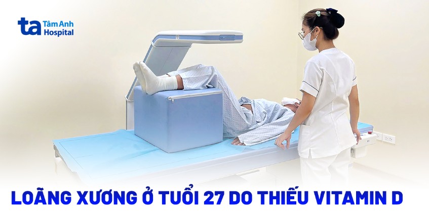 loãng xương ở tuổi 27 do thiếu vitamin d
