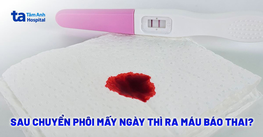 Máu báo thai sau chuyển phôi là gì?