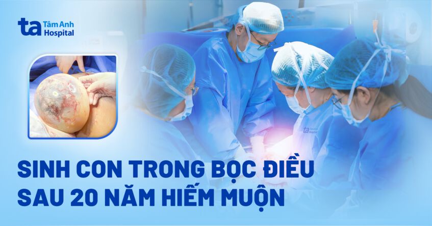 mẹ sinh em bé còn bọc điiều