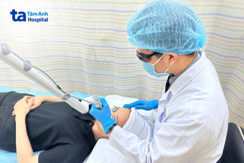 điều trị thâm môi bằng tia laser