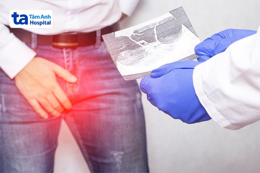 Nam giới bị tinh hoàn ẩn hai bên có nguy cơ vô sinh cao gấp 6 lần bình thường