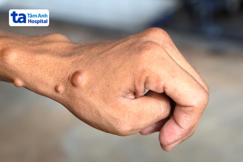 nên kiểm tra sức khỏe định kỳ