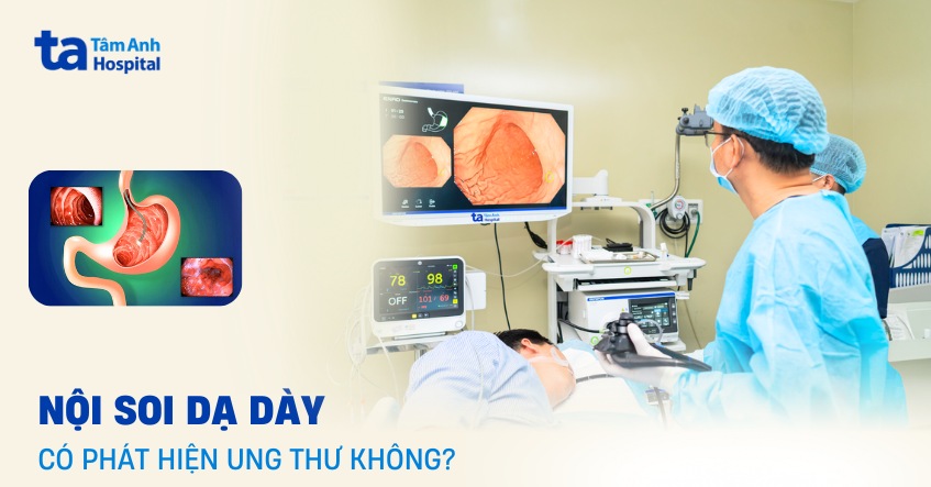 Nội soi dạ dày có phát hiện ung thư không? Có chính xác không?