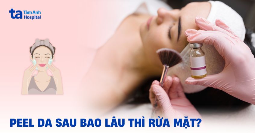 Sau peel da bao lâu thì rửa mặt được?