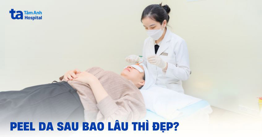 peel da sau bao lâu thì đẹp