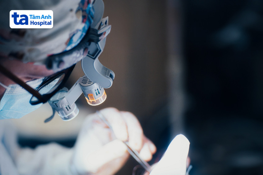 phẫu thuật để loại bỏ khối u