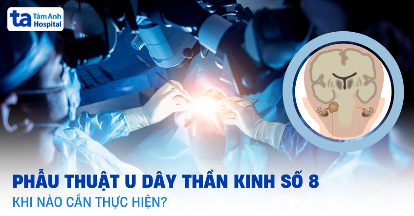 Phẫu thuật u dây thần kinh số 8: Mục tiêu, chỉ định và phương pháp