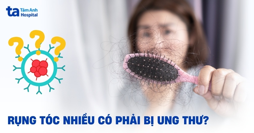 Rụng tóc nhiều có phải bị ung thư không? Khi nào cần lưu ý?