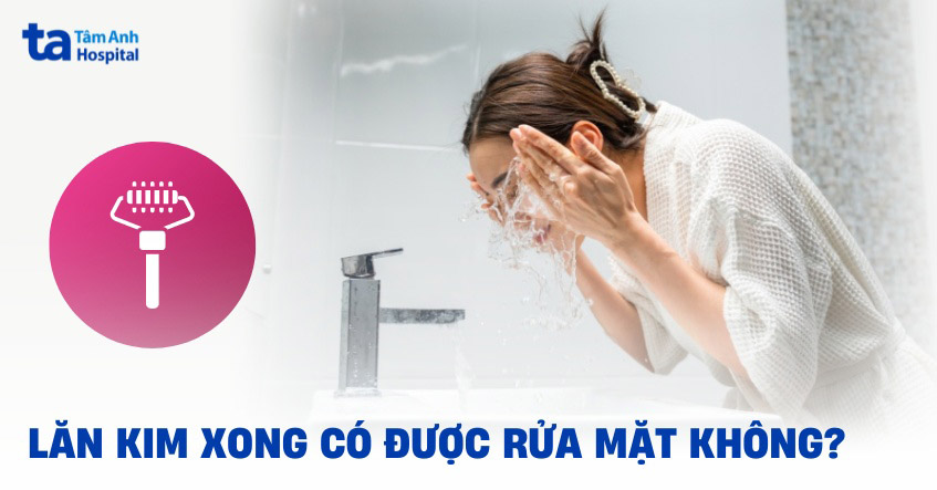 Sau lăn kim bao lâu thì được rửa mặt? Có cần kiêng nước không?