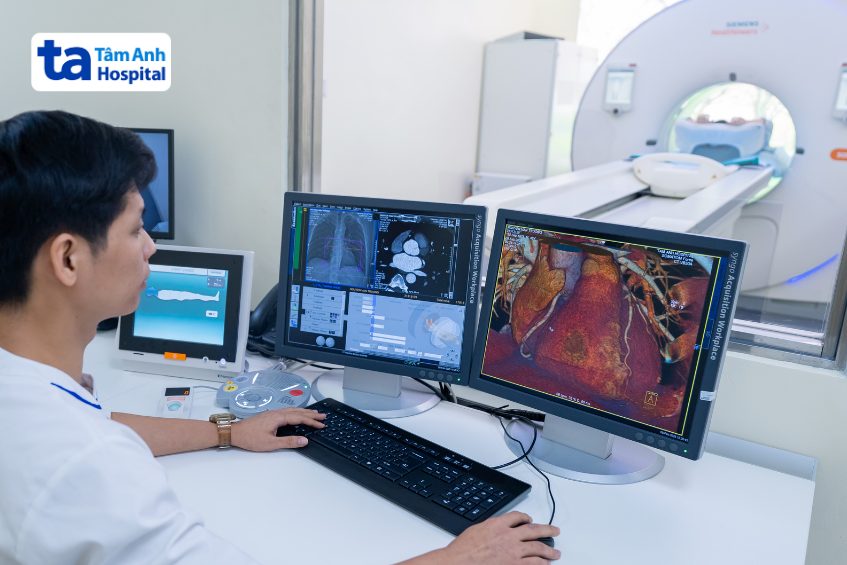 siêu máy chụp CT 100.000 lát cắt