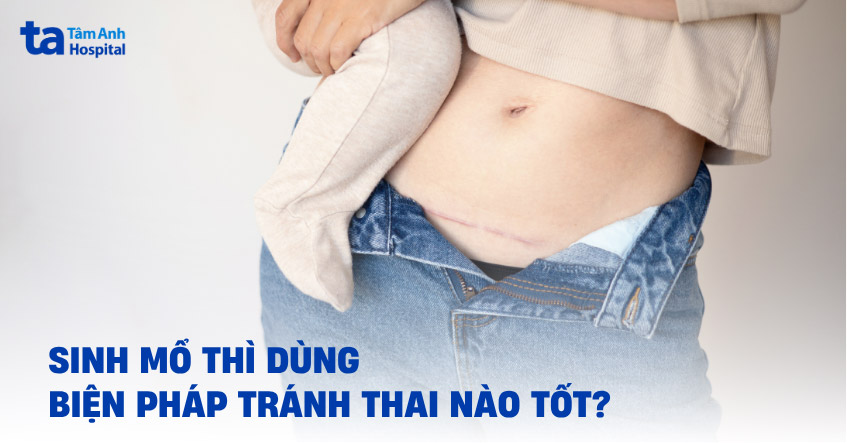 Sinh mổ thì dùng biện pháp tránh thai nào tốt?