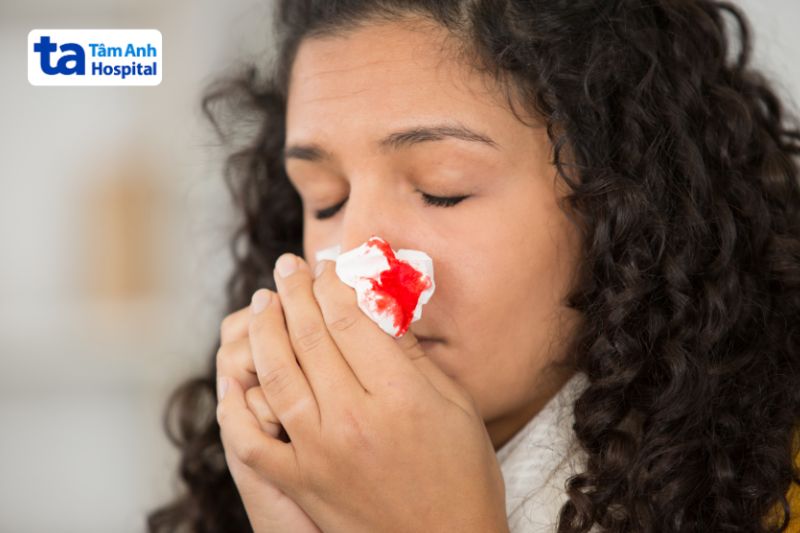 chảy máu cam khi sốt xuất huyết nguy hiểm