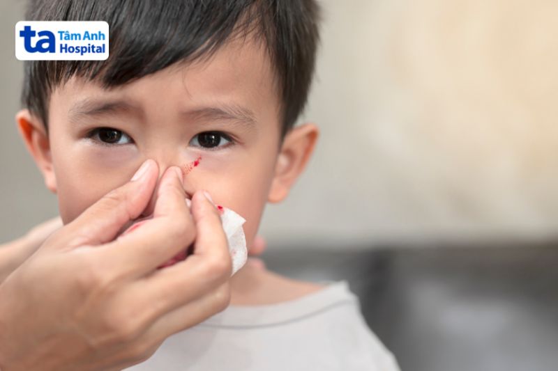 trẻ em bị sốt xuất huyết chảy máu cam