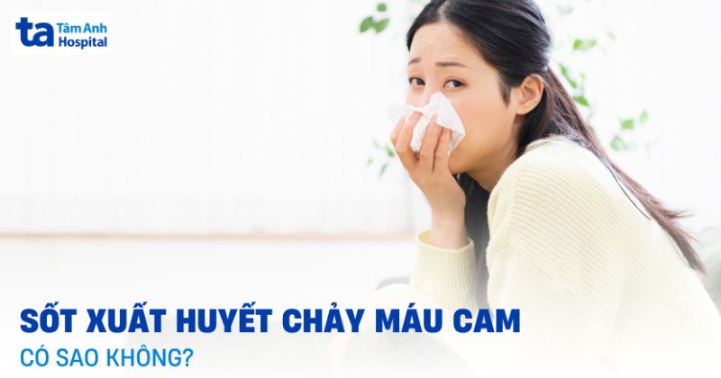 Sốt xuất huyết chảy máu cam (máu mũi) có sao không? Điều trị ra sao?