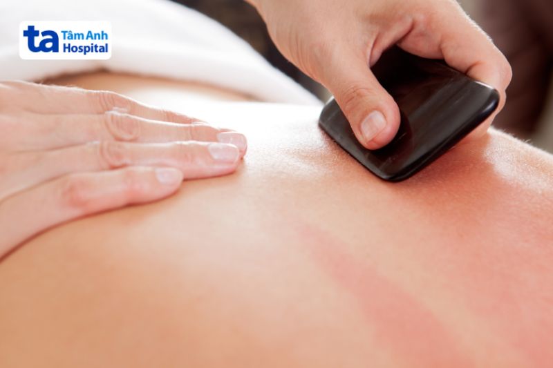 sốt xuất huyết không được cạo gió