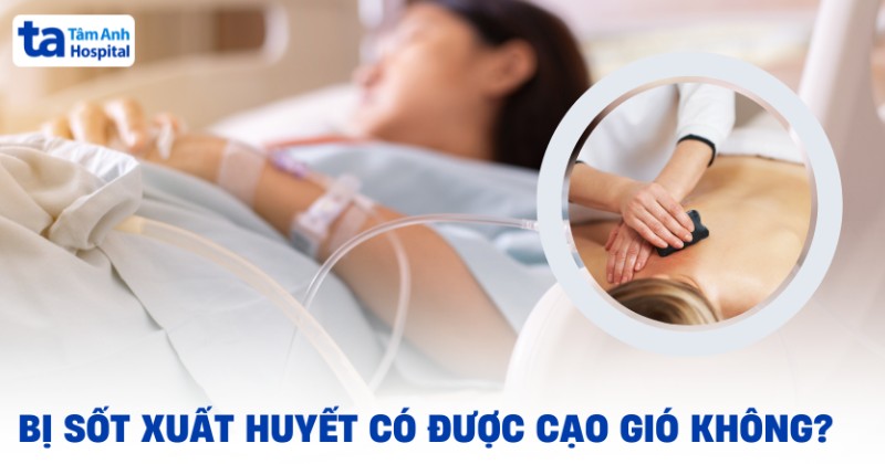 Sốt xuất huyết có được cạo gió không? Đánh gió có sao không?