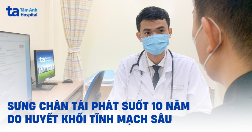 Sưng chân tái phát suốt 10 năm do huyết khối tĩnh mạch sâu
