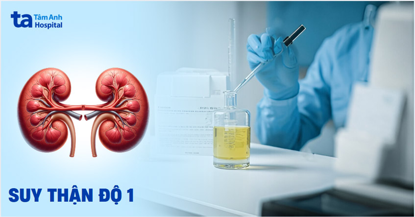 Suy thận độ 1 (giai đoạn đầu) và hướng phát hiện sớm