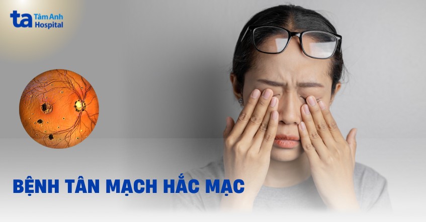 Tân mạch hắc mạc: Nguyên nhân, triệu chứng và điều trị