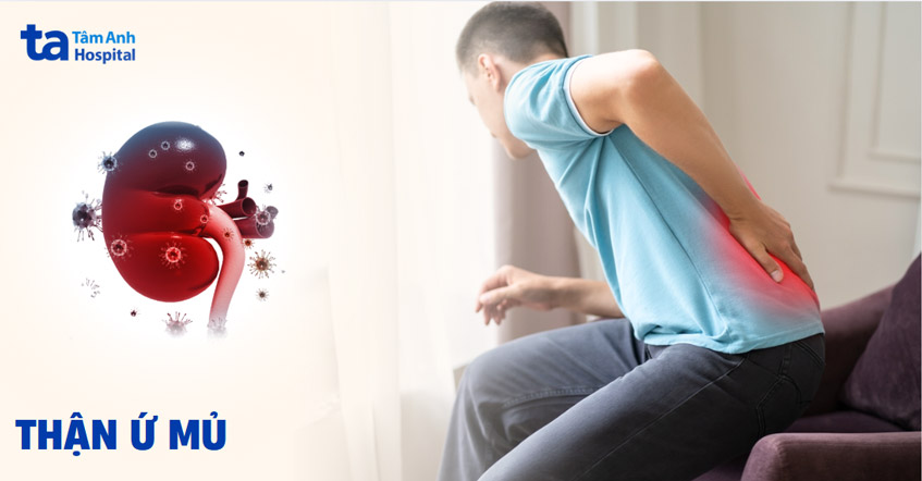 Thận ứ mủ: Nguyên nhân, dấu hiệu và cách điều trị hiệu quả