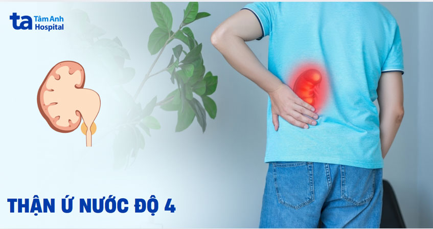 Xử trí thận ứ nước độ 4 bằng cách nào?