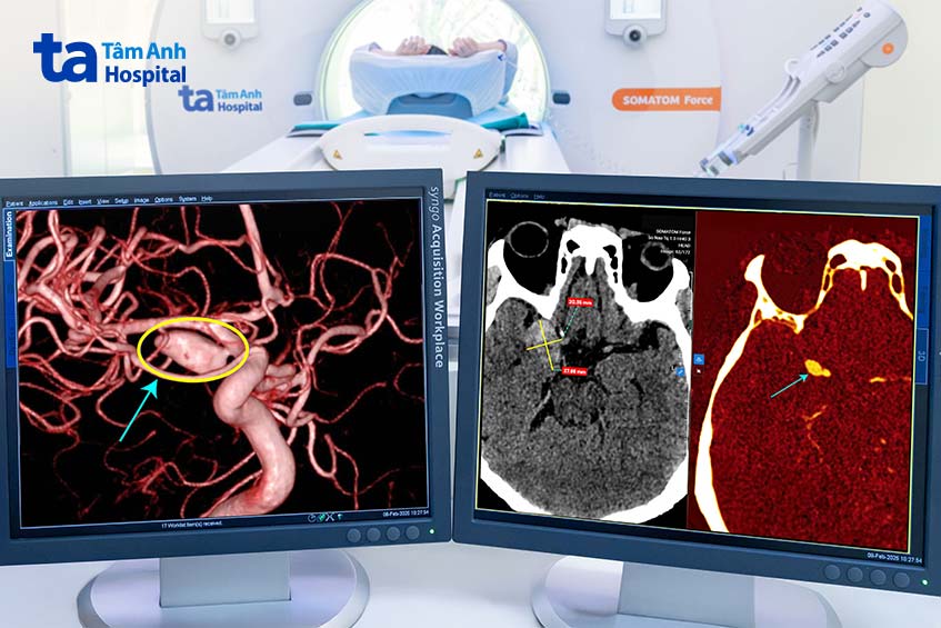 thiết bị hiện đại giúp can thiệp kịp thời