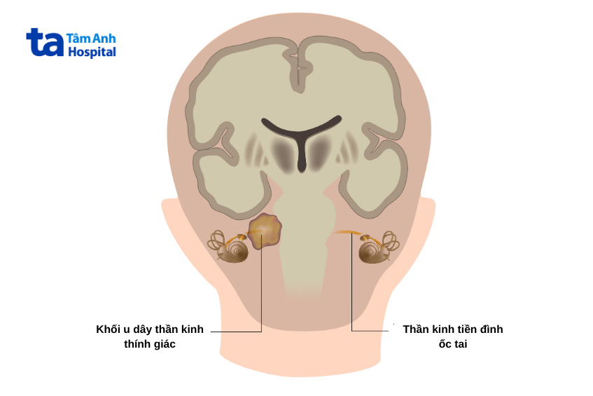 thời điểm phẫu thuật được chỉ định bởi bác sĩ