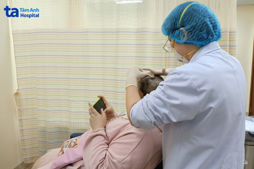thủ thuật lăn kim giúp tái tạo da