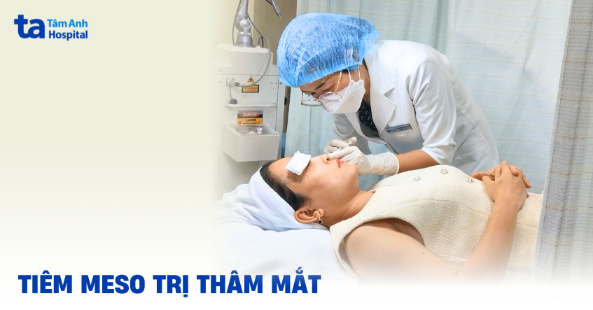 tiêm meso trị thâm quầng mắt