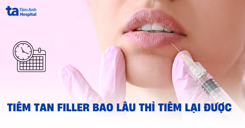 Giải đáp nhanh: Tiêm tan filler bao lâu thì tiêm lại được?