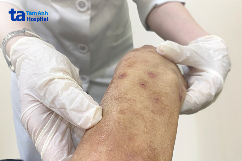 tình trạng bệnh của ông