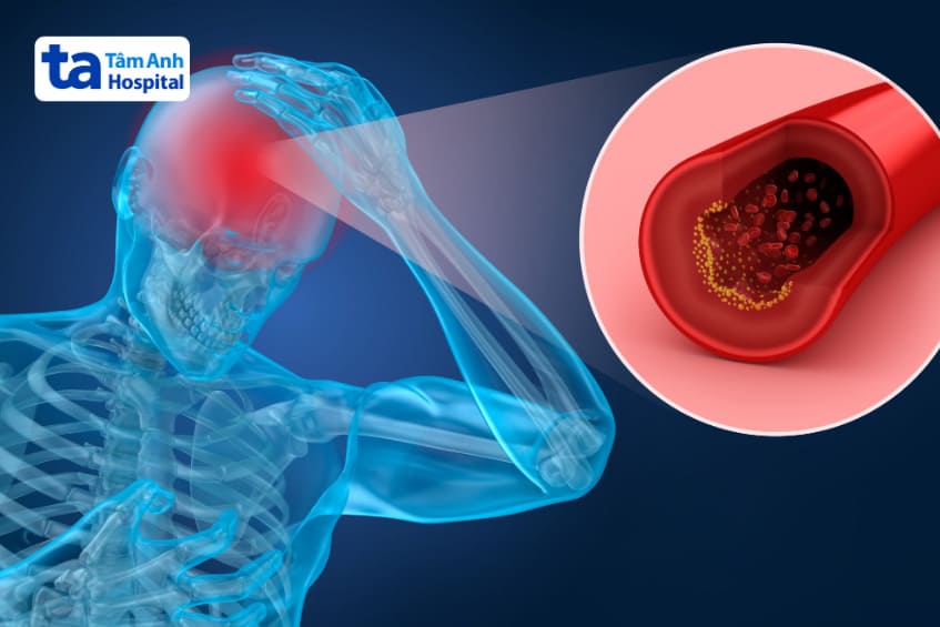 tình trạng này xảy ra ở nhiều người